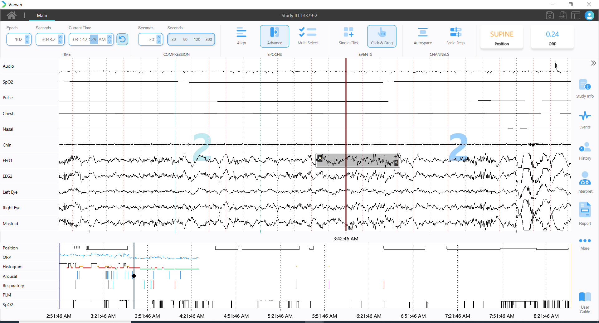 an image of a polysomnograph